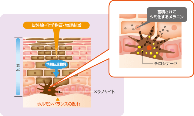 紫外線・化学物質・物理刺激 ホルモンバランスの乱れ 蓄積されてシミ化するメラニン