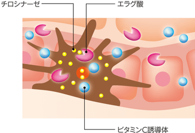 紫外線・化学物質・物理刺激 ホルモンバランスの乱れ 蓄積されてシミ化するメラニン