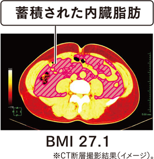 蓄積された内臓脂肪