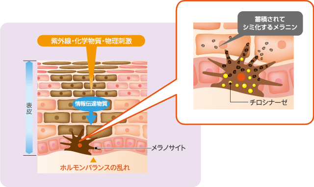 エラグ酸がシミを抑制するメカニズム ライオン公式通販サイト ライオン ウェルネスダイレクト